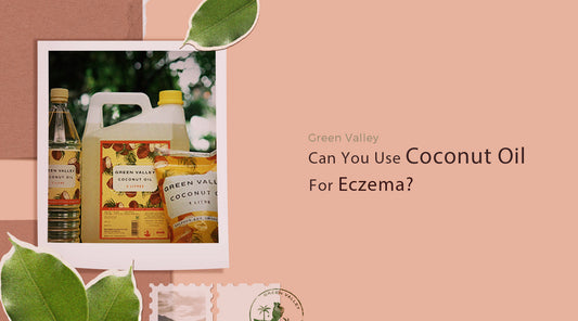 Can You Use Coconut Oil For Eczema?