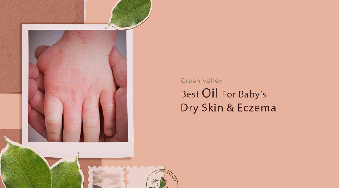 Best Oils For Baby's Dry Skin And Eczema